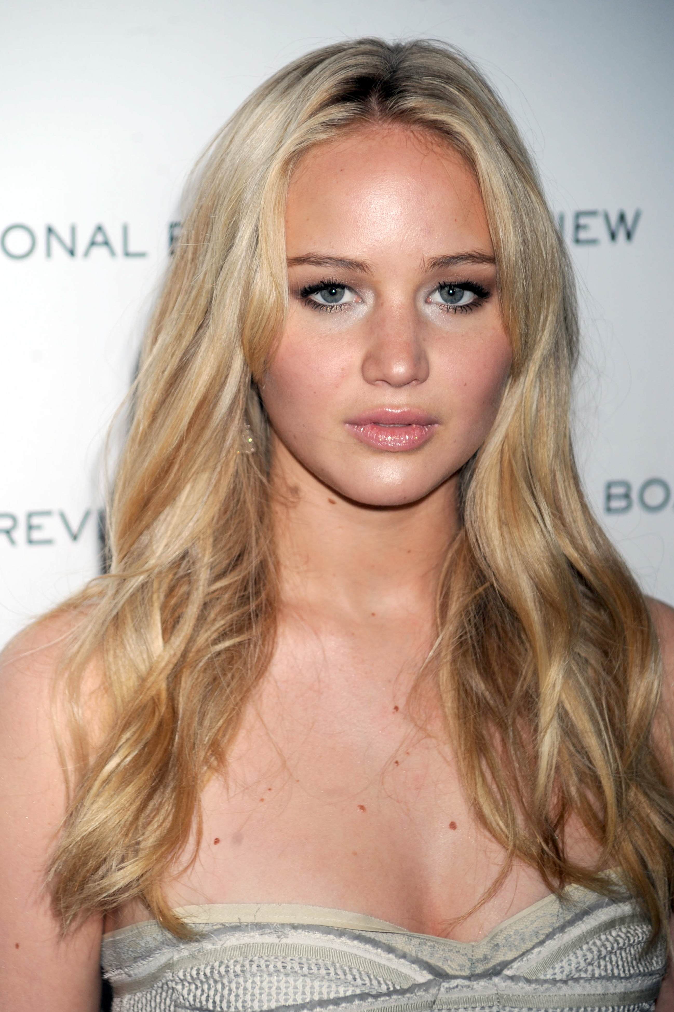 Jennifer lawrence moles