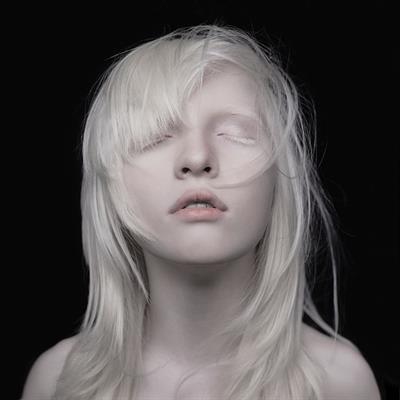 Beautiful albinos model
