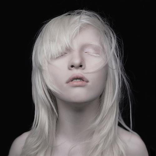 Beautiful albinos model