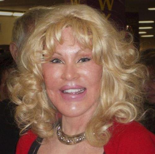 Jocelyn Wildenstein