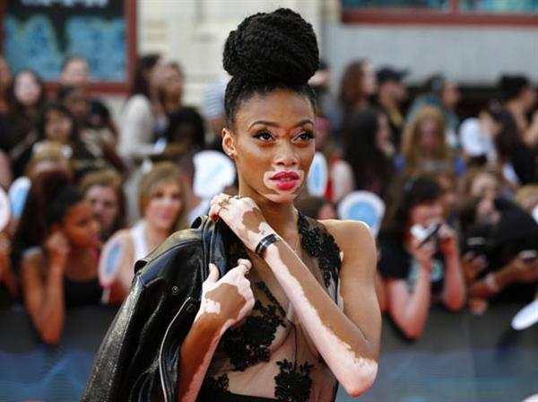 Winnie Harlow