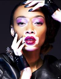 Winnie Harlow
