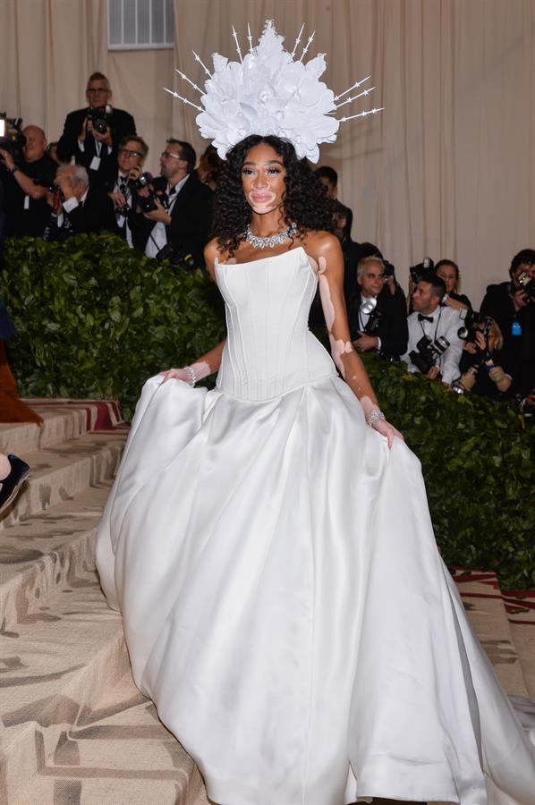 Winnie Harlow