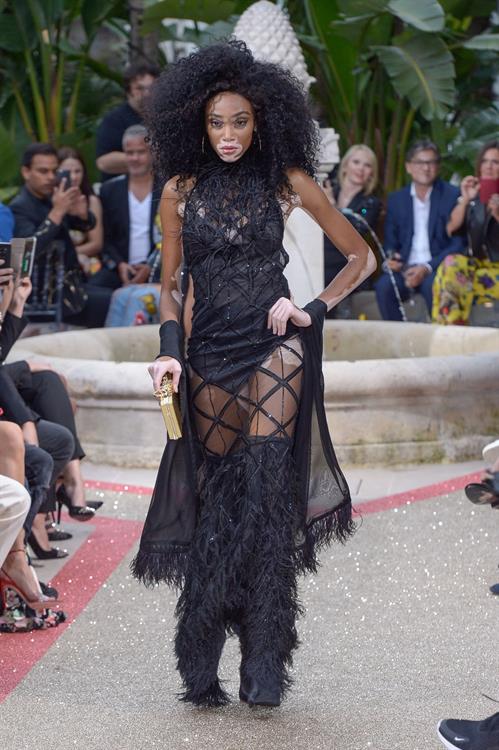 Winnie Harlow