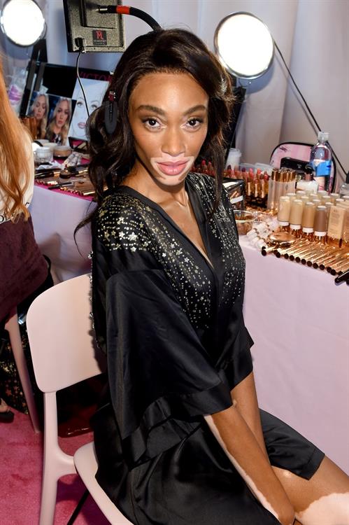 Winnie Harlow