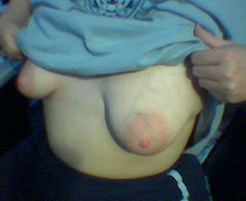 Anonymous - breasts